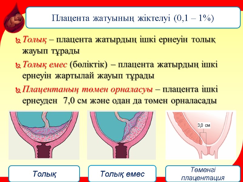 Толық – плацента жатырдың ішкі ернеуін толық жауып тұрады  Толық емес (бөліктік) –